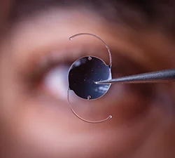 Expert eye treatment and vision care at Retiora Eye Care